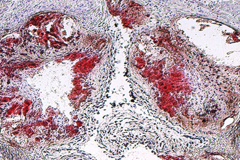 Atherosclerotic lesions appear in red in this image of a mouse aorta from a Cedars-Sinai study. Photo by Cedars-Sinai.