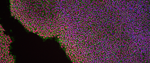 Induced Pluripotent Stem Cell Core