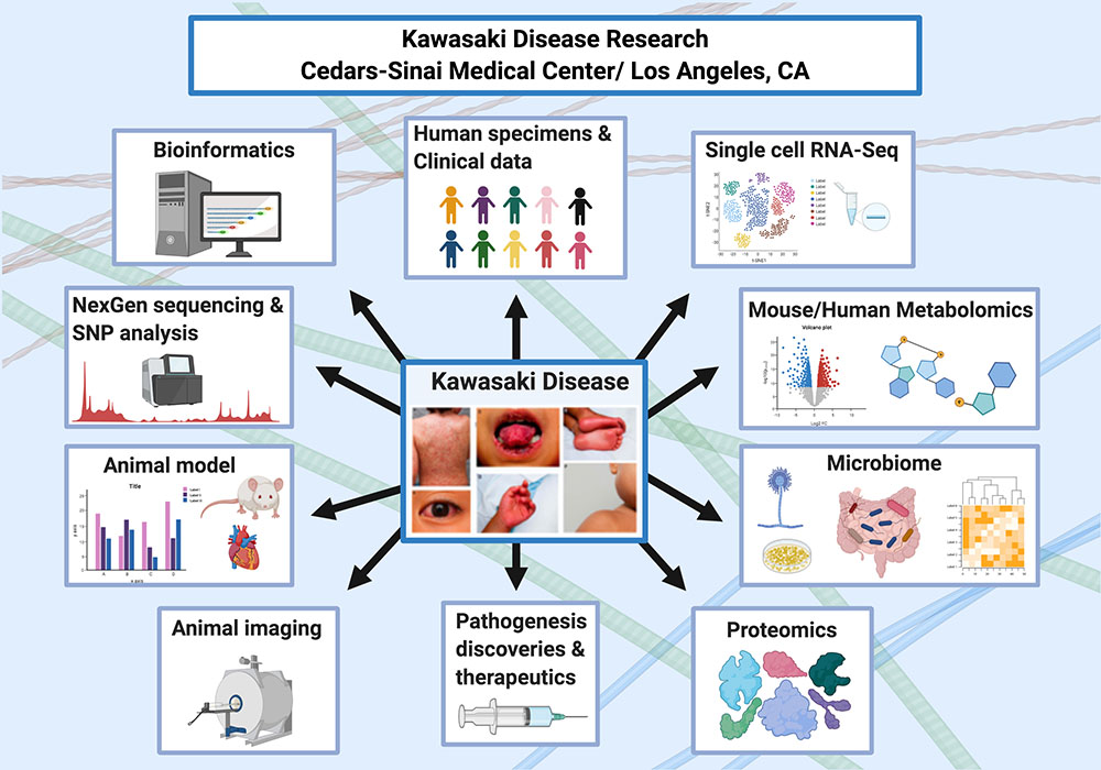Graphic of Kawasaki Diseases Research at Cedars-Sinai
