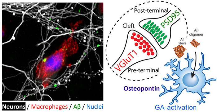 Figure 2. Synaptic and neurite preservation from toxic Aβ1-42 oligomers obtained by GA-activated monocyte-derived macrophages. Red: a macrophage expressing high levels of scavenger receptor; Green: Aβ1-42 oligomers; White: Neuronal processes (in primary neuronal culture). From the Koronyo-Hamaoui Lab: Li, et al., Front. Immunol. 2020. 