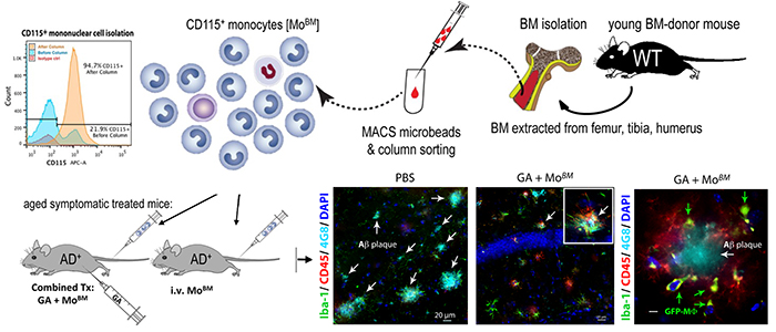 Figure 5. Therapeutic effects of infusing bone marrow-derived monocytes from a young healthy mouse to an Alzheimer's-model mouse, mitigation of brain pathology and restoration of cognitive abilities. From Koronyo-Hamaoui Lab: Koronyo et al., Brain 2015