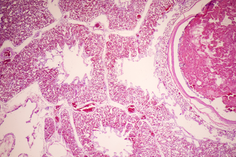 Lung histology