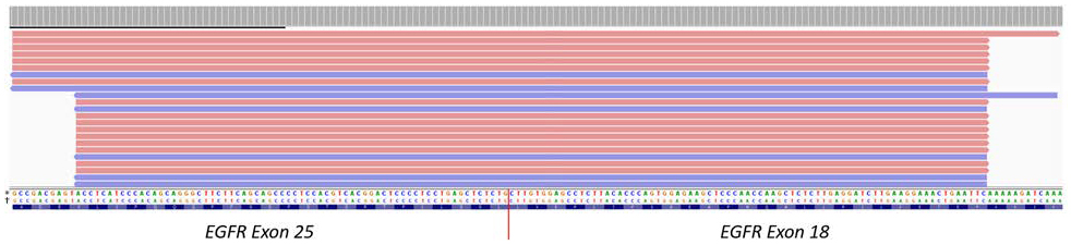 Visualization of EGFR‐KDD variant using the IGV Browser.