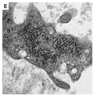 Transmission electron micrograph of tubuloreticular inclusion in peritubular capillary endothelial cell cytoplasm.