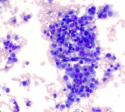 Giemsa stain (400X)