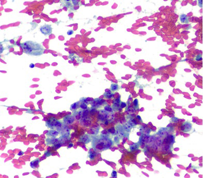 Papanicolaou stain (400X)