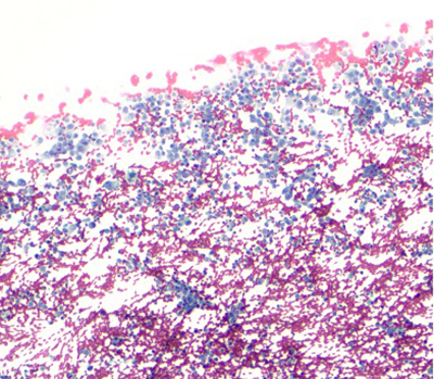 Papanicolaou stain (100X)