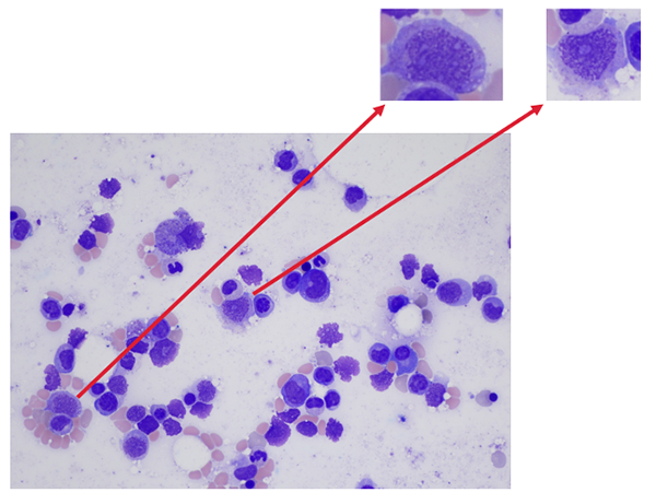 Bone marrow biopsy zoomed in