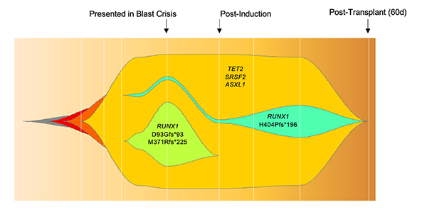 Graph of blast crisis, post-induction, and post-transplant.