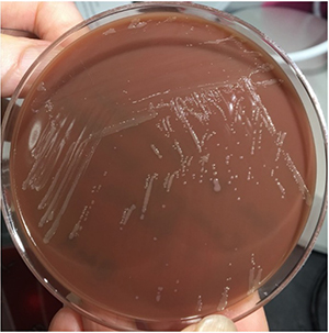 Chocolate agar plate