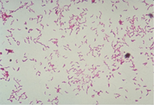 Microscopic view of gram stain
