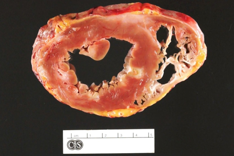 Cardiovascular Pathology examination