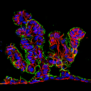 Intestine-Chip