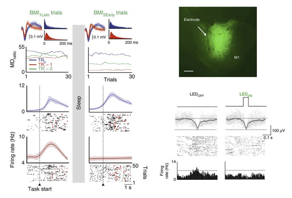 Network basis of motor behavior in intact & injured states.