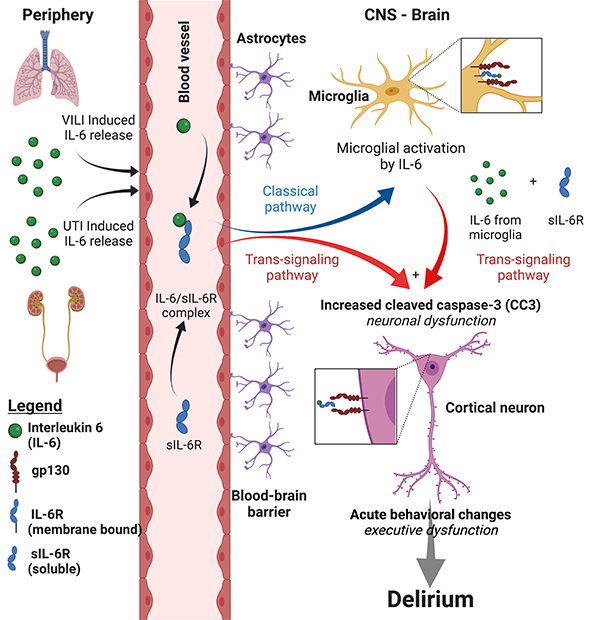 Reseach model by Shouri Lahiri, MD from Cedars-Sinai