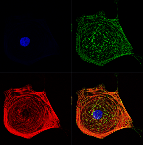 Purified human induced pluripotent stem cell-derived cardiomyocytes for use in cardiac disease modeling. From Sharma et al 2017, Science Translational Medicine.