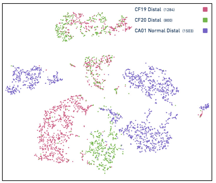 Single-cell RNA-Seq reveals the unique molecular phenotype of epithelial cells in lungs of patients with CF lung disease.