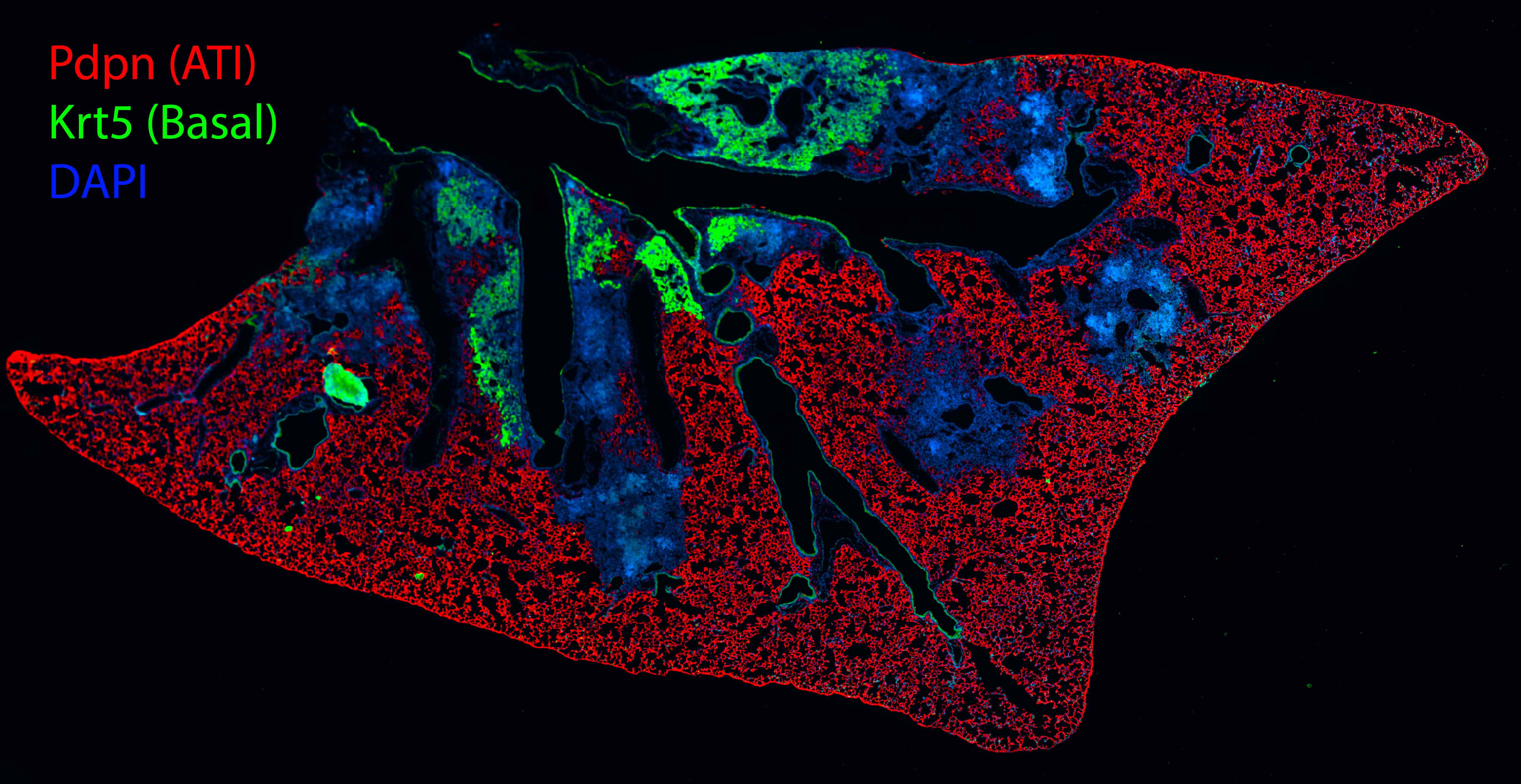 Alveolar destruction and structural lung remodeling following infection of mice with H1N1 influenza virus. 