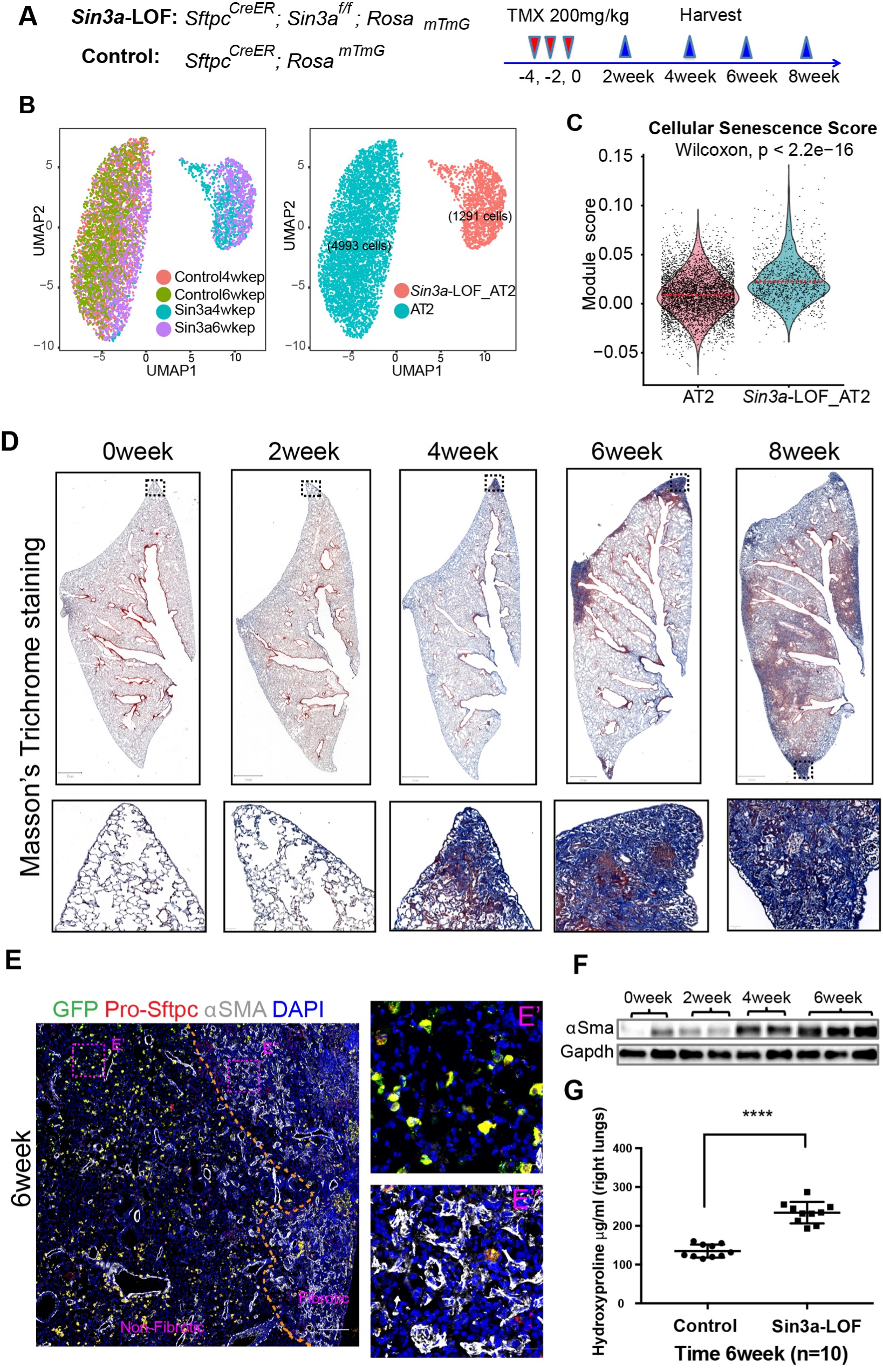 Progressive pulmonary fibrosis following conditional modulation of the epigenome in alveolar type 2 cells.