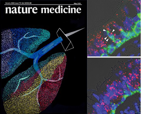 Single cell RNA-Seq reveals the unique molecular phenotype of epithelial cells in lungs of patients with CF lung disease. 