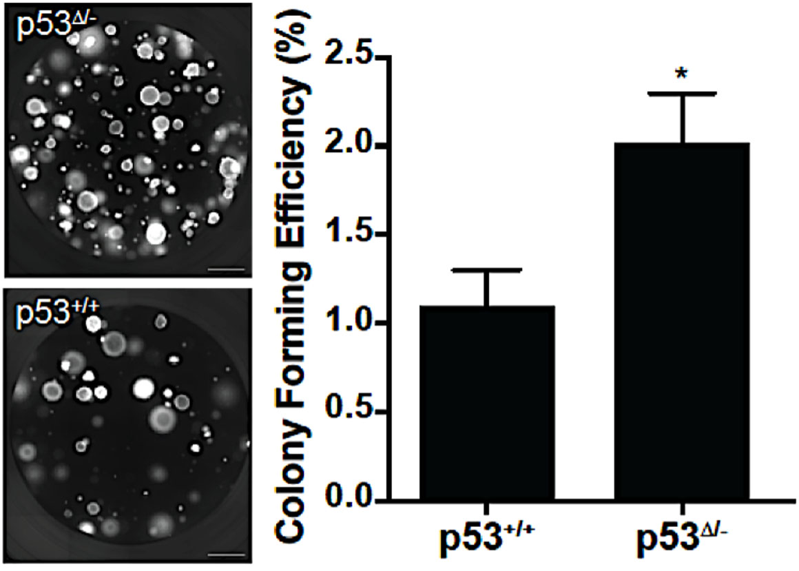 p53 loss-of-function in airway progenitor cells increases colony-forming efficiency (CFE)