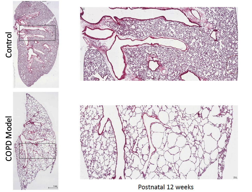 Progressive postnatal emphysema in mice following gene alterations regulating histone modifications in lung mesenchyme. 