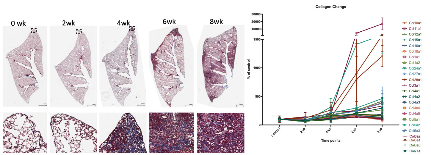 Progressive pulmonary fibrosis following conditional modulation of the epigenome in alveolar type 2 cells.