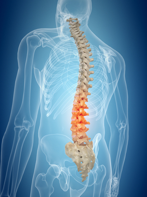 lower back pain, Cedars-Sinai, research, treatment